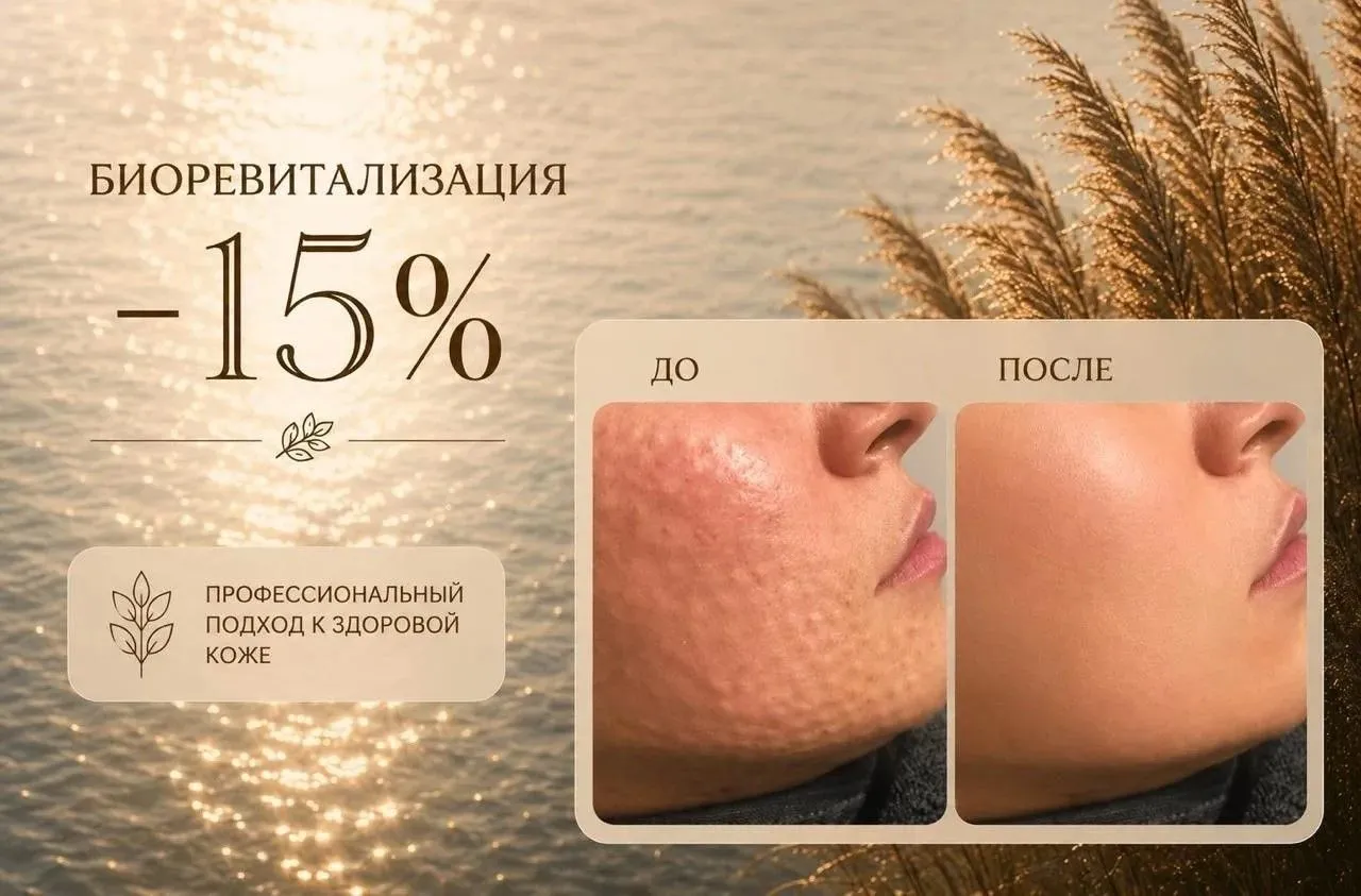 Выгода 15% на лифтинг и увлажнение
